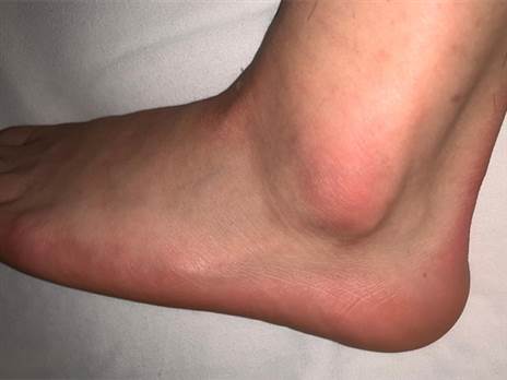 "חזיזה לא הרגיש את זה בכלל"