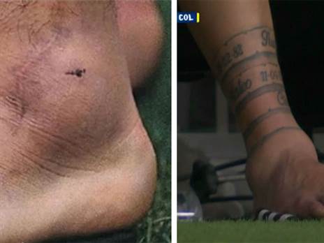 הפציעות של מסי ומראדונה