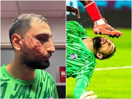 לא נעים בכלל. הפציעה של דונארומה (GETTY, RMC)