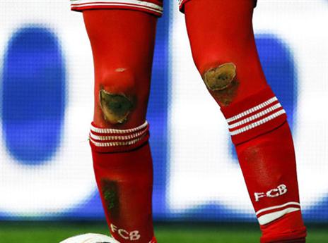 בפעם הבאה תנסה סלטה. הברכיים של רובן (gettyimages)