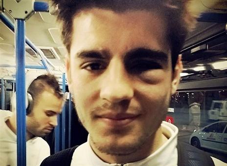 מוראטה, לא נעים (צילום: איקר קסיאס)