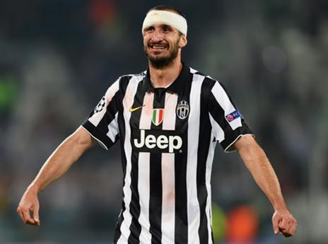 קייליני בלוק הלוחמני (Getty)