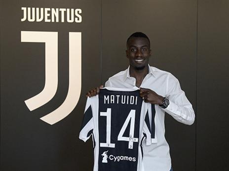 מטווידי. לא קשר העל לו מצפים בטורינו (Getty)