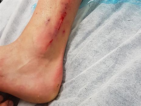 הקרסול של פקהארט. בספק למכבי ת"א