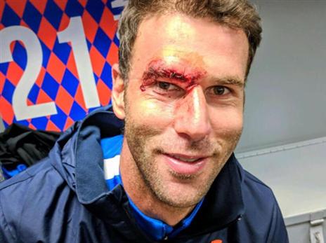 הפך למנהיג של סינסינטי (טוויטר)