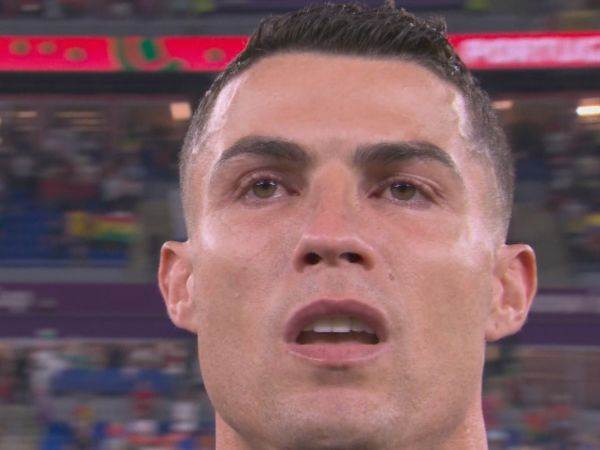 עיניים אדומות