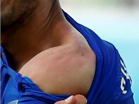 ההרחקה יותר כואבת (gettyimages)