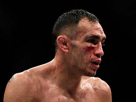 הפרצוף של פרגוסון אומר הכל (getty)