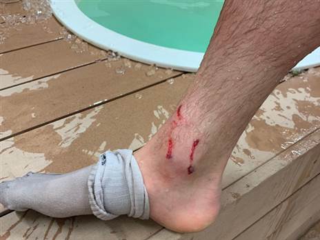 הרגל של ליואיץ' בסיום