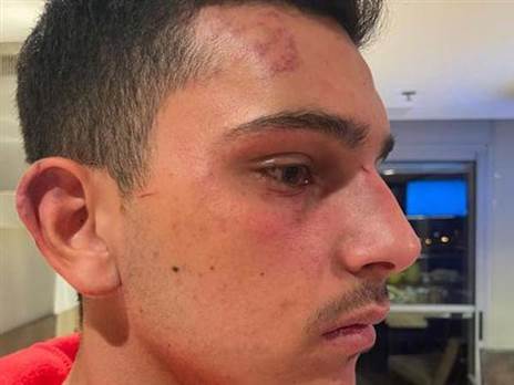 האוהד בן ה-17 שהותקף בסמי עופר (צילום מסך)