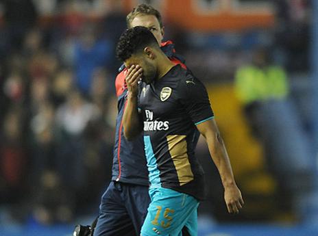 אוקסלייד-צ'מברליין. הסגל קצר, ואנחנו רק באוקטובר (gettyimages)