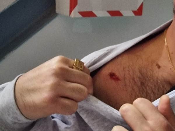 אוהד ירושלמי שנפגע