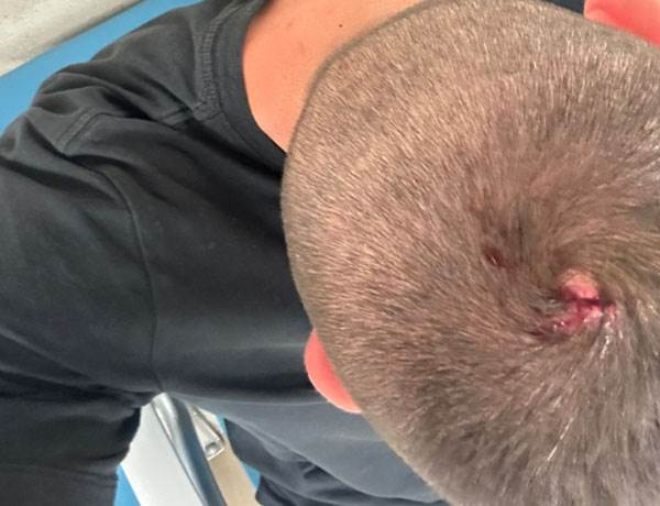 השוטר שנפצע (דוברות המשטרה)