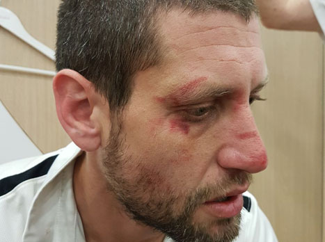 פיזיותרפיסט הפועל, רמי אינגל שהוכה