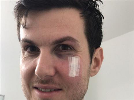 "היה כאוס באימונים, גם בגלל רייס ג'וניור"