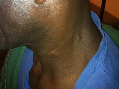 הצוואר של סימס אחרי התקיפה