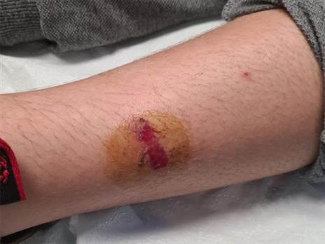 הפגיעות בגופו של הנער