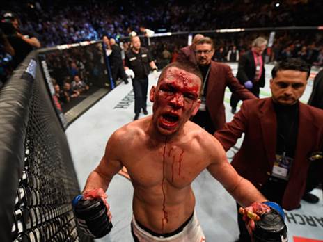 אין קרב לו שלא מסתיים בלי דם על הקנבס. דיאס (GETTY)