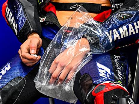 שבר ת האמה ביד שמאל (צילום: motoGP)