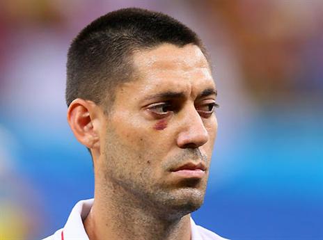 נפצע למען המולדת