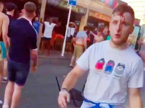 אוהד מדמם אחרי העימותים (טוויטר)