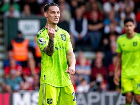 אנתוני. עדויות קשות (GETTY)