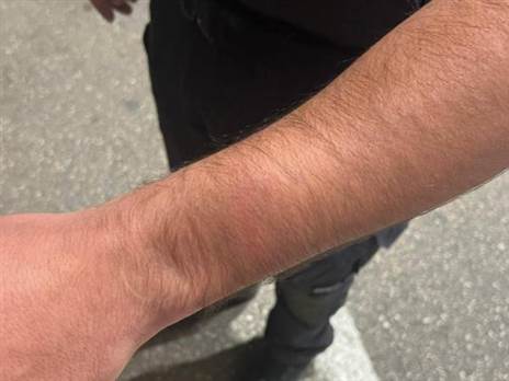 תמונת השוטר שנפגע (תמונות באדיבות דוברות המשטרה)