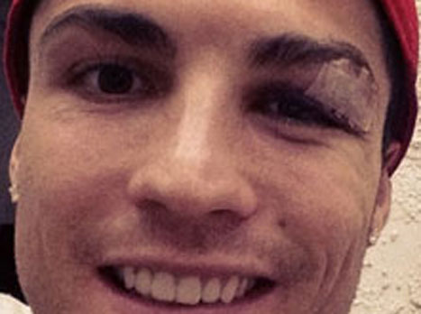 רונאלדו חבוש בתמונה שהעלה מהפייסבוק. מה לא תסלח לנבארו?