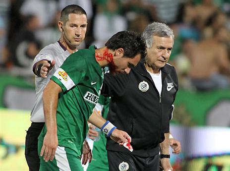 שיימן נפצע ונטש (יוסי שקל)