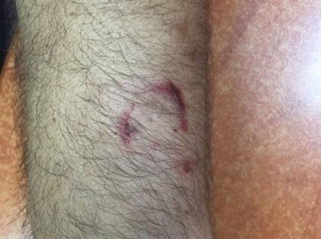 האוהד עדיין לא נתפס