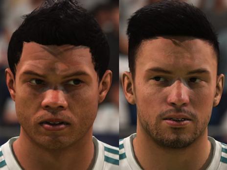 אסניסו וקארסקו רק חלק מהשחקנים שזקוקים לתיקוני פנים במשחק.