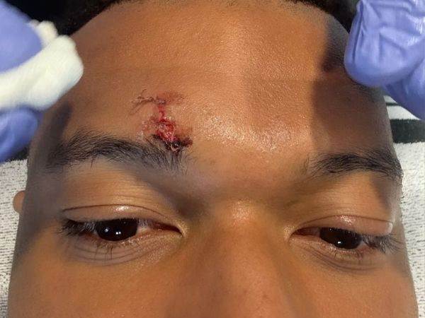 נדרש לתפרים. הגבה של אמבפה (מקור: האינסטגרם של קיליאן אמבפה)