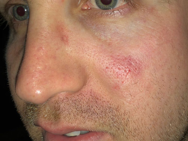 האוהד לא התלונן. גרין יעמוד לדין