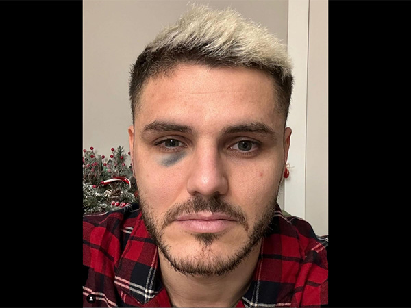 (גלאטסראיי, רשמי)