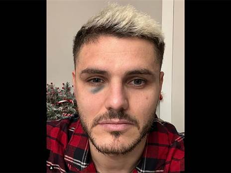 (גלאטסראיי, רשמי)