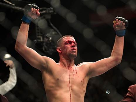 “אני לא מופתע בני *****“. דיאז (GETTY)