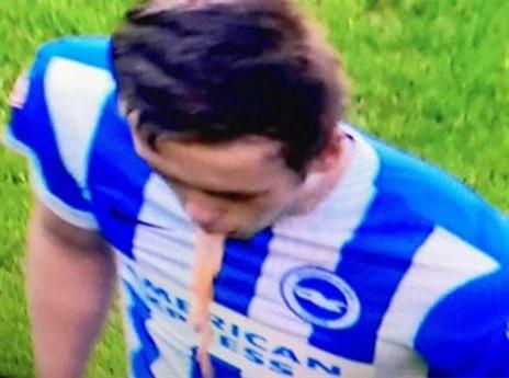 חגג אתמול יותר מדי? ווילסון מקיא על המגרש