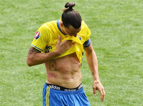 סבל מקייליני (gettyimages)