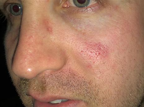 האוהד לא הגיש תלונה בסופו של דבר