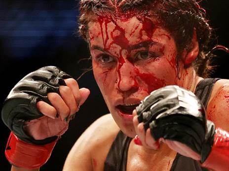 לא מעט דם נשפך הערב. פנייה (GETTY)