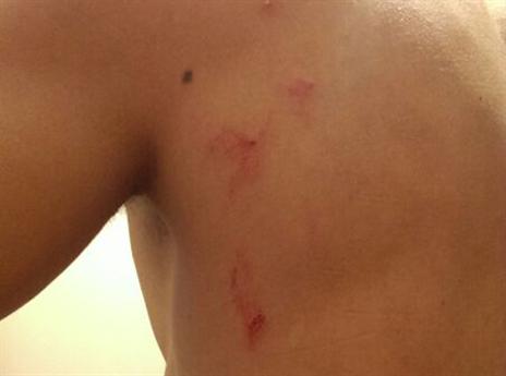 כך נראה הגב של אבו ענזה (מתוך פייסבוק)