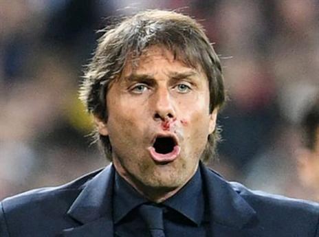 קונטה מדמם מהאף (צילום מסך)