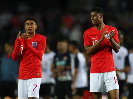 כמו תמיד, אופטימיות במחנה האנגלי (getty)