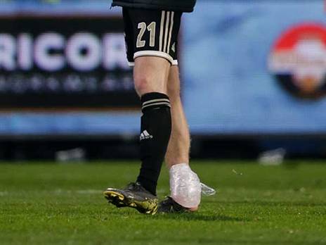 הרגל הפצועה של דה יונג (getty, Soccrates images)