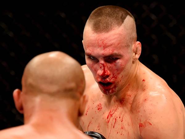 אחד המדממים בהיסטוריה. מאקדונלד (GETTY)