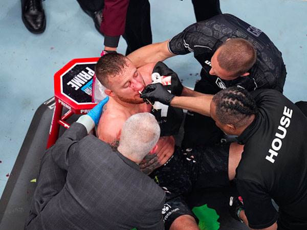 מתאושש מההפסד. גייצ`י (GETTY)