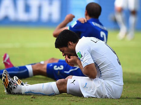 הנושך והננשך. שניהם לא מבינים (gettyimages)