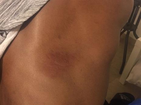 גופו החבול של קורטני פלס