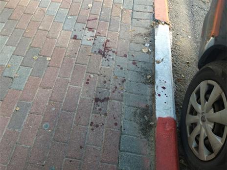 זירת התקרית באשדוד