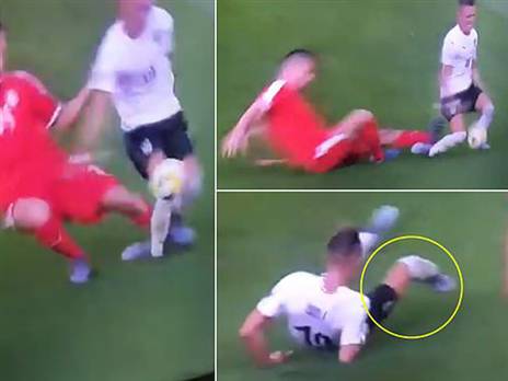 פציעה נוראית לוולף